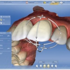 Dijital Diş Hekimliği